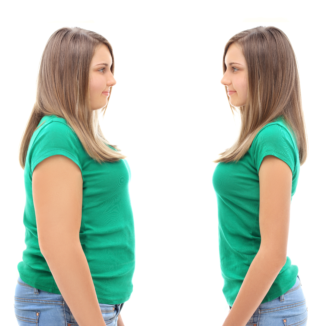 Weight Loss Treatments in NYC