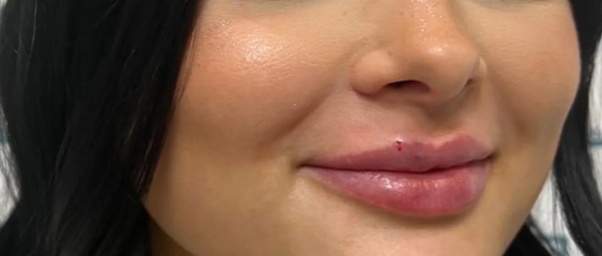 Premium Medical Spa in New York | Timelyss Med Spa