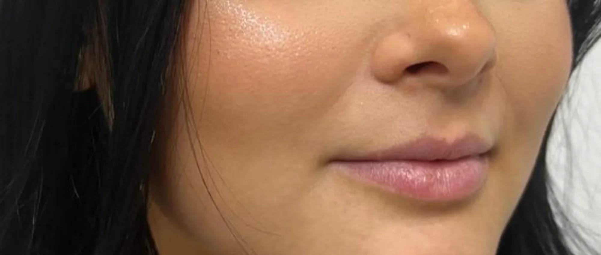 Premium Medical Spa in New York | Timelyss Med Spa