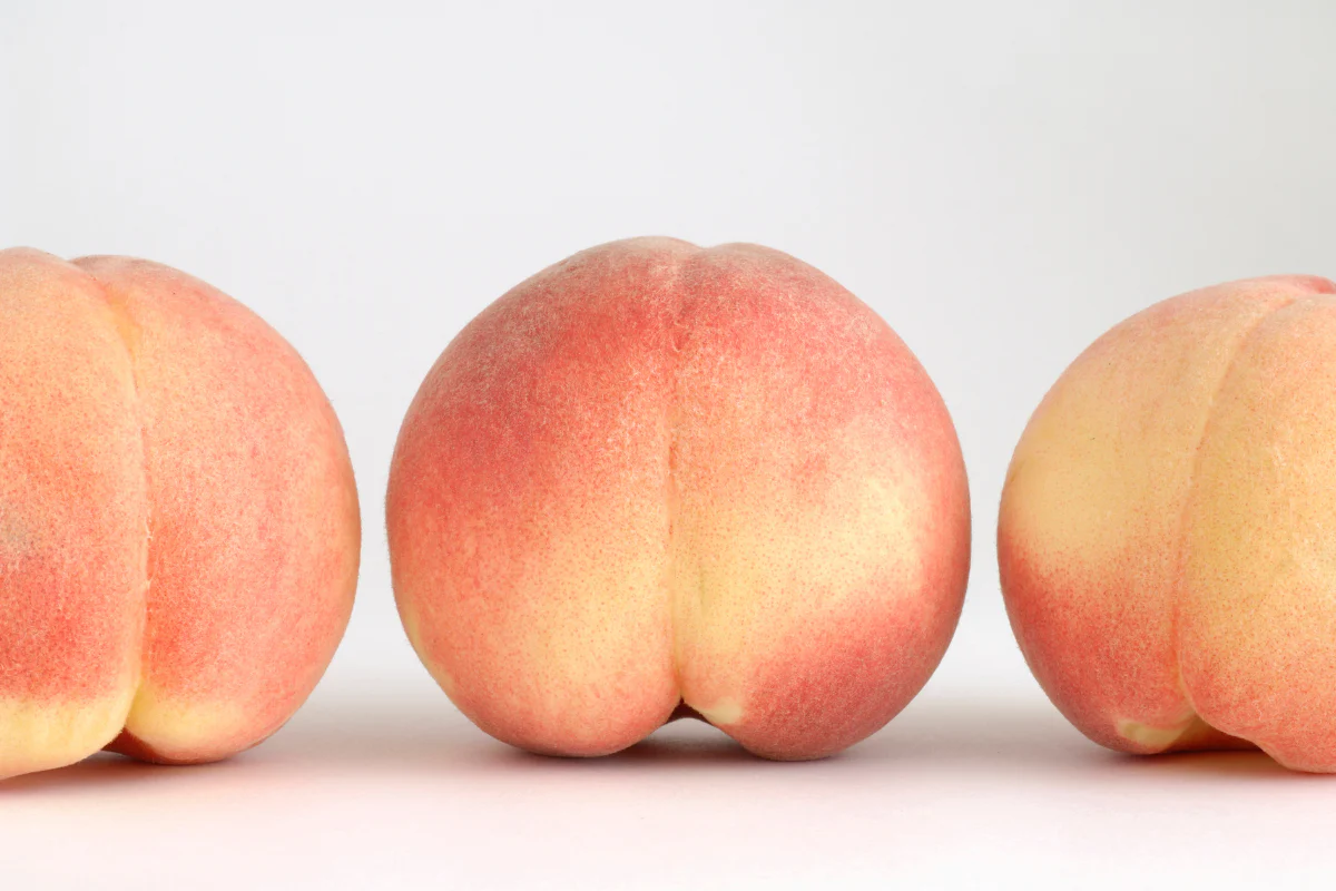 BBL Treatment in New York | Timelyss Med Spa