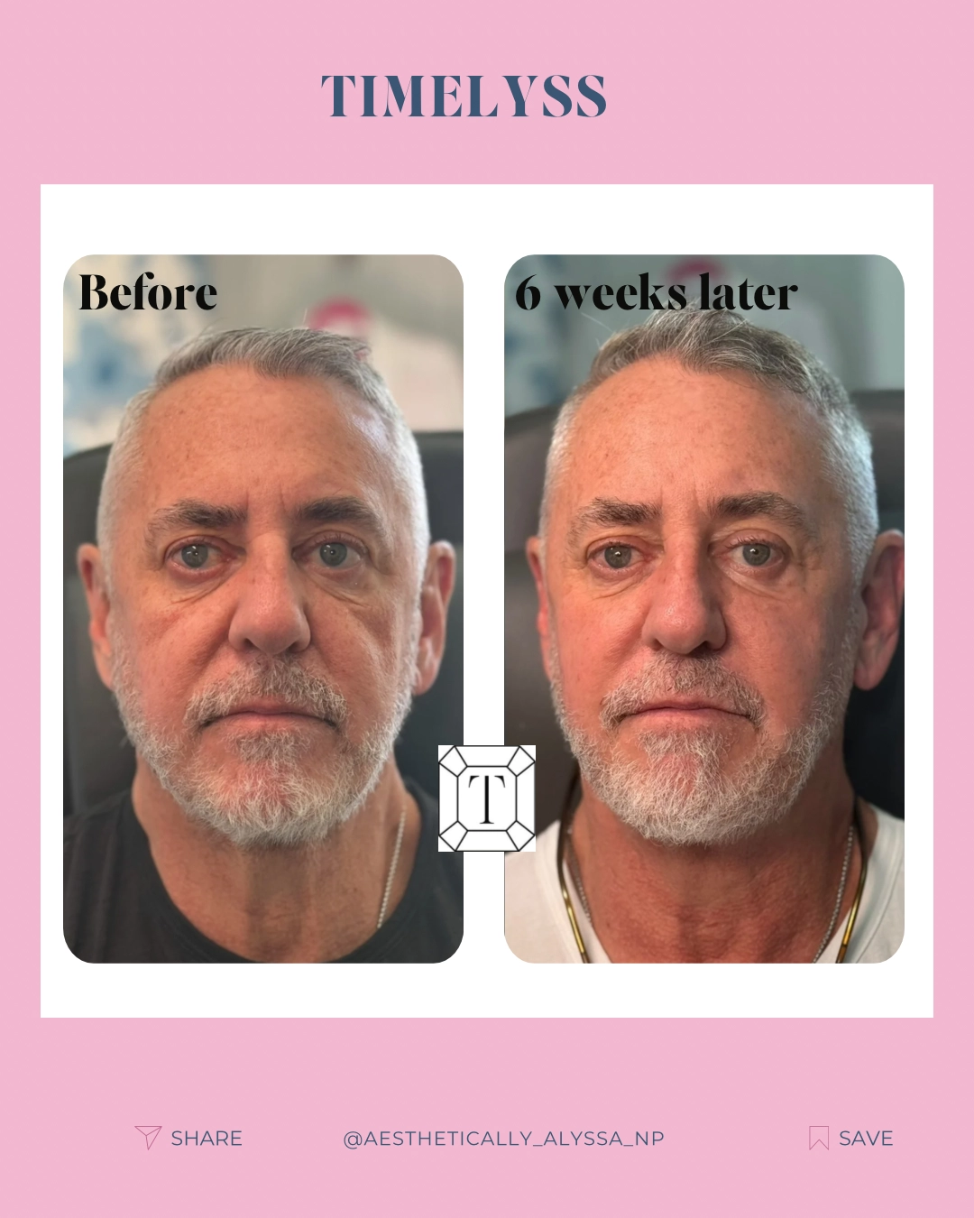 Medical Aesthetic Services in New York by Timelyss Med Spa