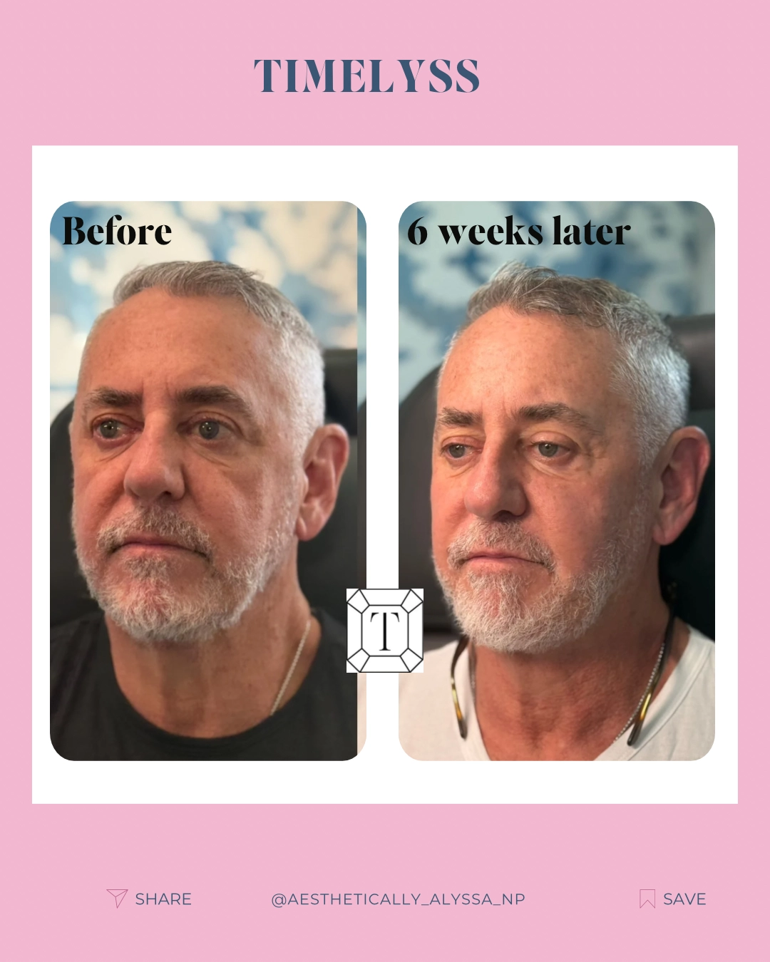 Medical Aesthetic Services in New York by Timelyss Med Spa