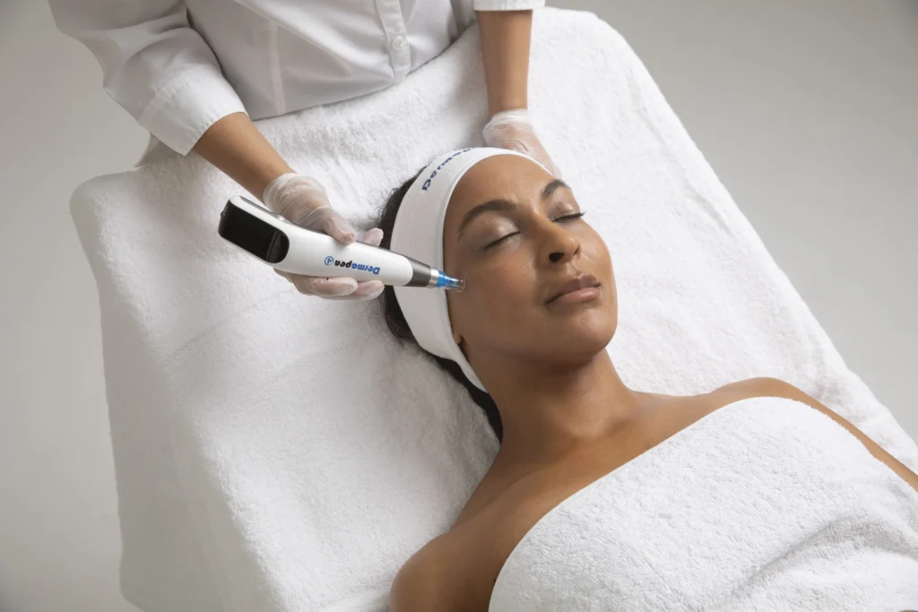 Microneedling in New York by Timelyss Med Spa