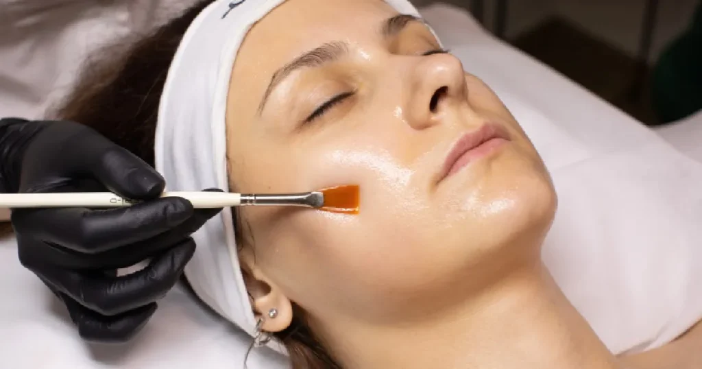 Women receiving Chemical Peel Treatment in New York, NY