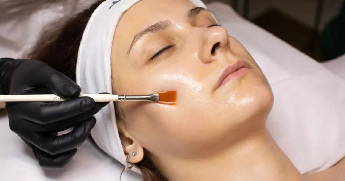 Women receiving Chemical Peel Treatment in New York, NY